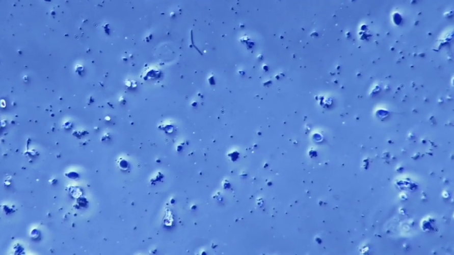 5-minute explainer: how to understand log reductions